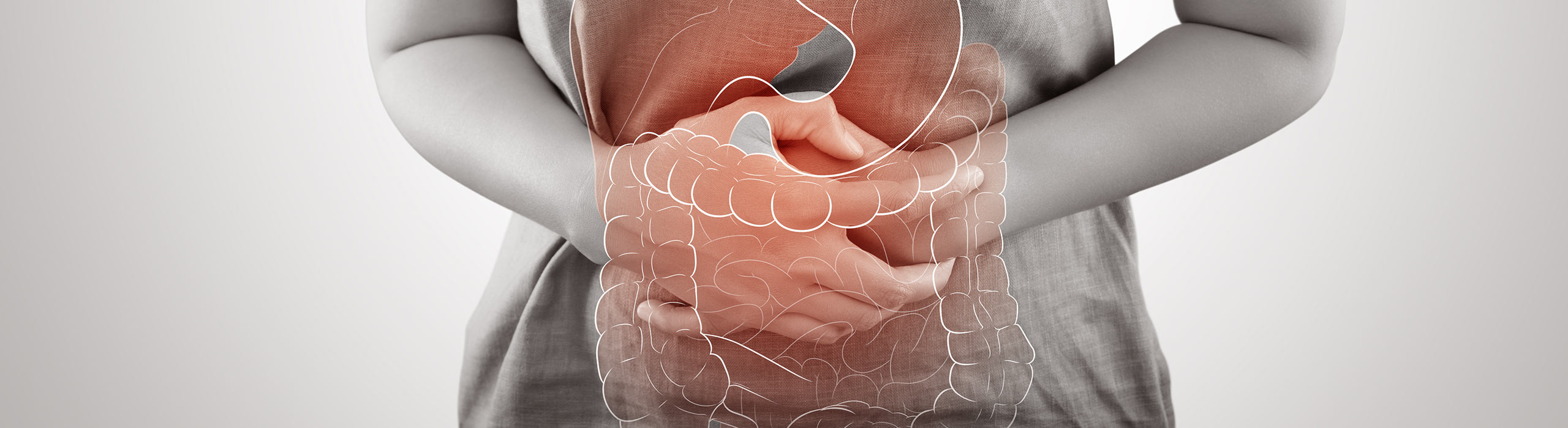Ulcerative Colitis Synexus